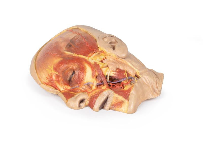 Superficial Face 3D Replica MP1108 | Erler-Zimmer | Candent 2