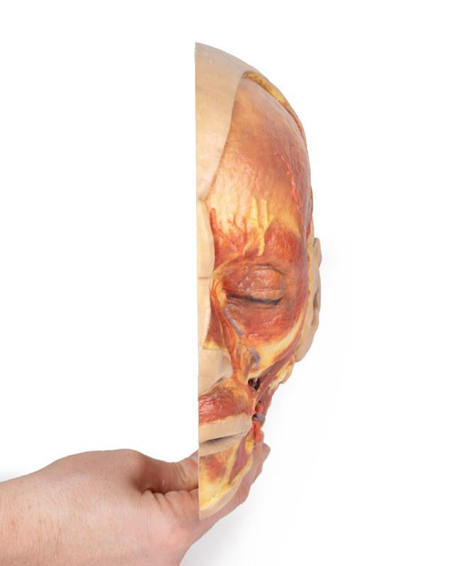 Superficial Face 3D Replica MP1108 | Erler-Zimmer | Candent 4