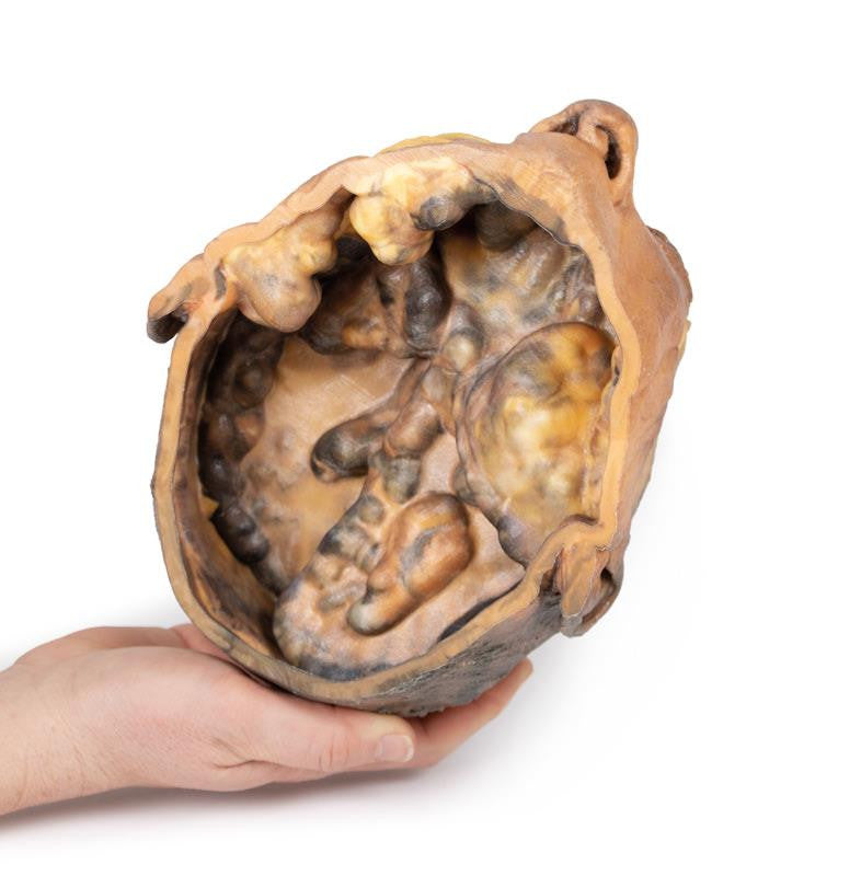 Transverse Section of the head 3D Replica MP1110 | Erler-Zimmer | Candent 3