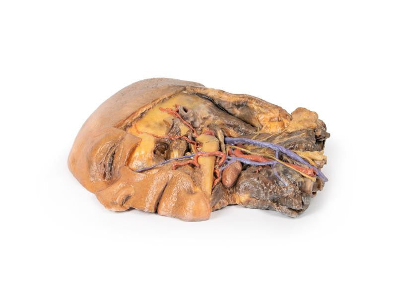 Sagittal Section of Head and Neck with Infratemporal Fossa and Carotid Sheath Dissection 3D Replica MP1111 | Erler-Zimmer | Candent