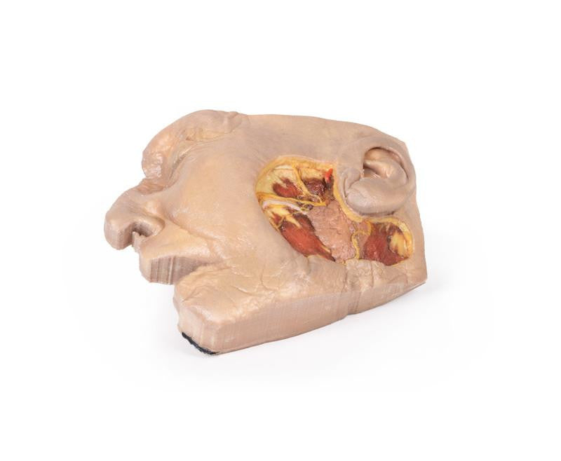 Parotid Gland and Facial Nerve dissection 3D Replica MP1112 | Erler-Zimmer | Candent 2