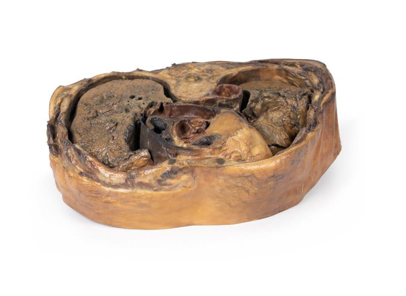 Thoracic cross section at T6 3D Replica MP1120 | Erler-Zimmer | Candent 2