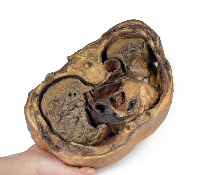 Thoracic cross section at T6 3D Replica MP1120 | Erler-Zimmer | Candent 3