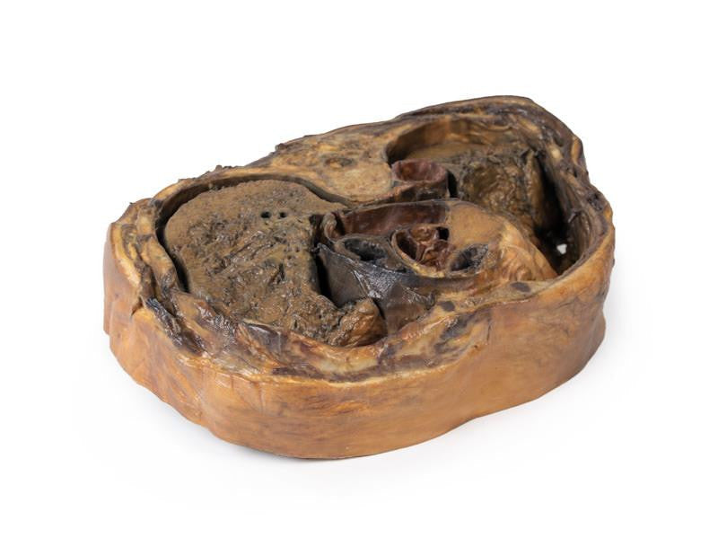 Thoracic cross section at T6 3D Replica MP1120 | Erler-Zimmer | Candent 4