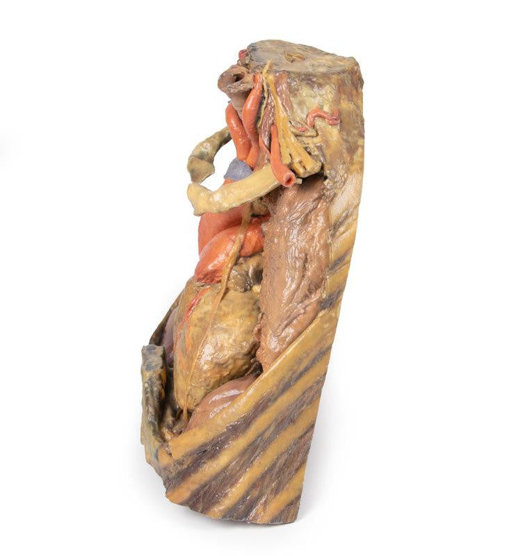 Thorax with heart and vessels 3D Replica MP1122 | Erler-Zimmer | Candent 4