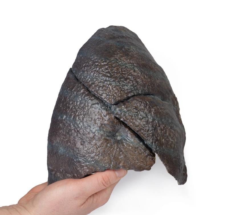 Right lung, hilum removed 3D Replica MP1126 | Erler-Zimmer | Candent