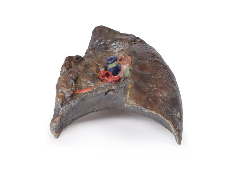 Hilum of the right lung 3D Replica MP1127 | Erler-Zimmer | Candent 4