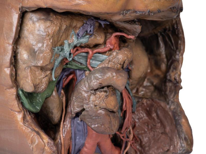 Abdomen vasculature 3D Replica MP1131 | Erler-Zimmer | Candent 2