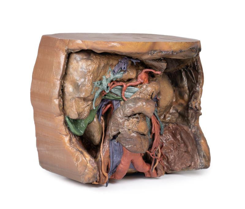 Abdomen vasculature 3D Replica MP1131 | Erler-Zimmer | Candent 4