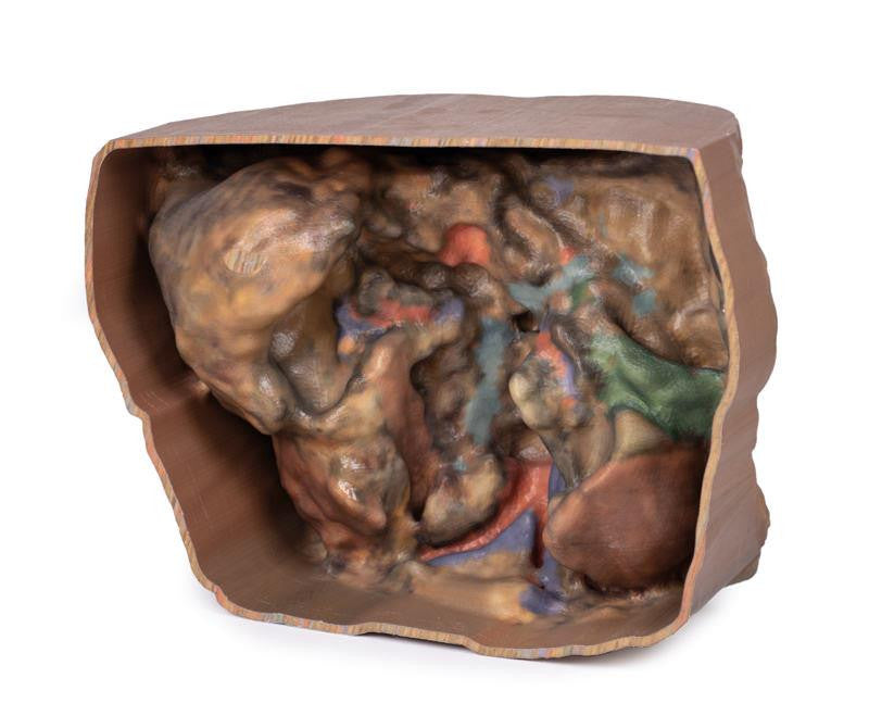 Abdomen vasculature 3D Replica MP1131 | Erler-Zimmer | Candent 3