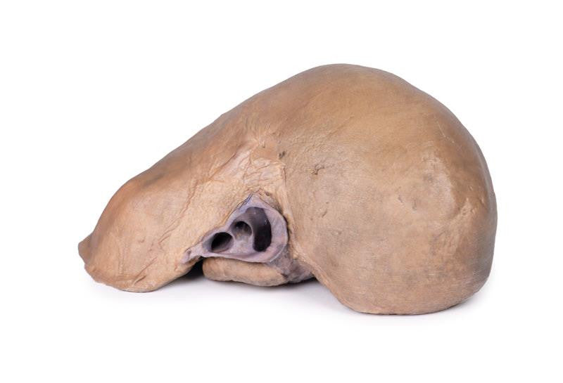 Liver with vessels and gallbladder 3D Replica MP1136 | Erler-Zimmer | Candent