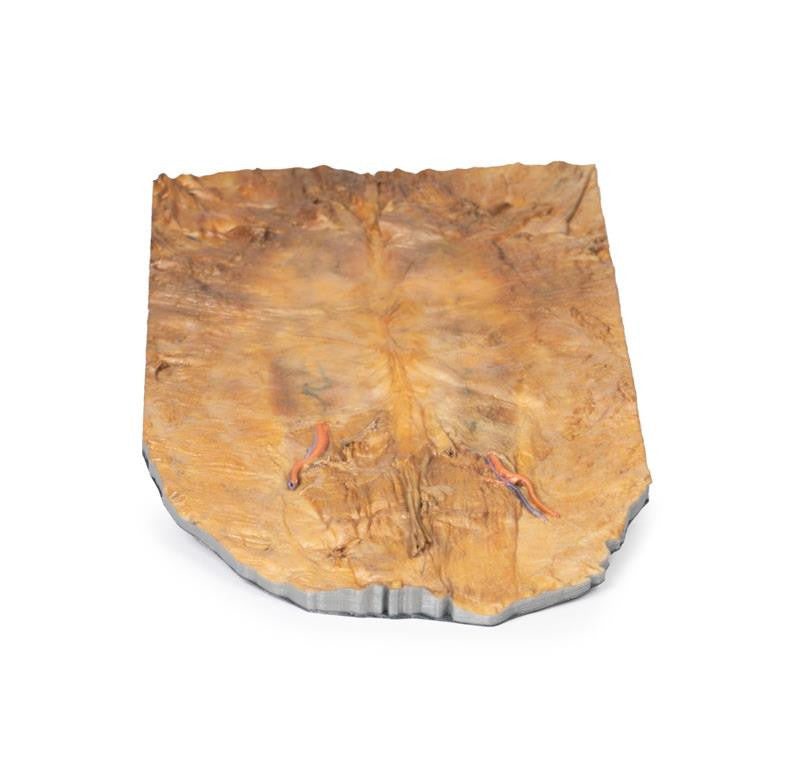 Internal abdominal wall 3D Replica MP1137 | Erler-Zimmer | Candent 2