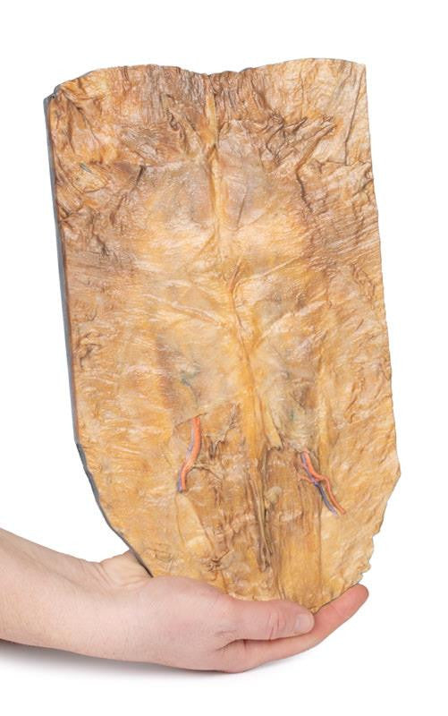 Internal abdominal wall 3D Replica MP1137 | Erler-Zimmer | Candent 3