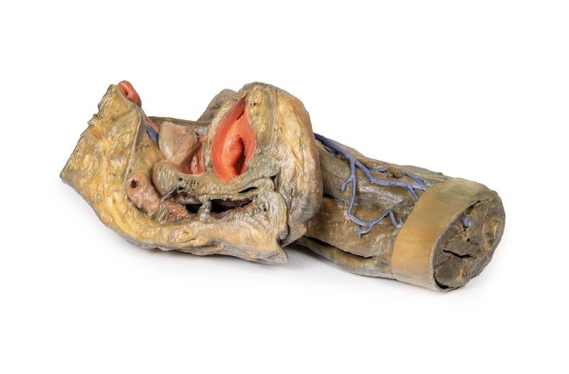 Female hemipelvis and thigh 3D Replica MP1140 | Erler-Zimmer | Candent 2