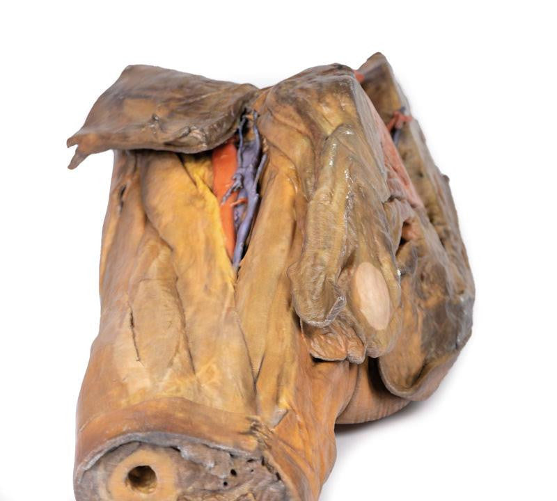 Male hemipelvis and thigh 3D Replica MP1142 | Erler-Zimmer | Candent