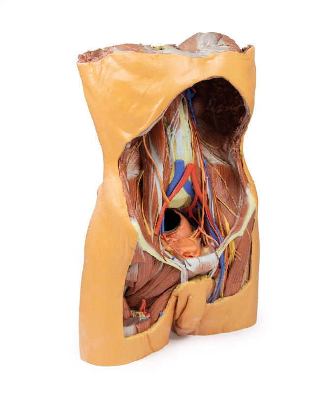Posterior Abdominal Wall - 3D Printed Cadaver