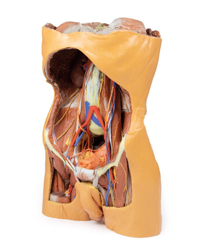 Posterior Abdominal Wall - 3D Printed Cadaver