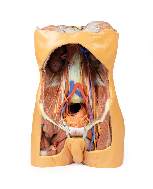 Posterior Abdominal Wall - 3D Printed Cadaver