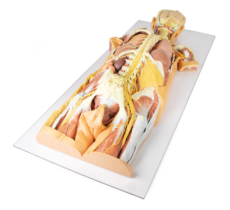 Nervous System Dissection (posterior view) - 3D Printed Cadaver