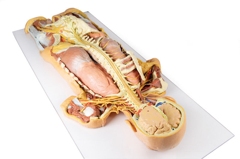 Nervous System Dissection (posterior view) - 3D Printed Cadaver