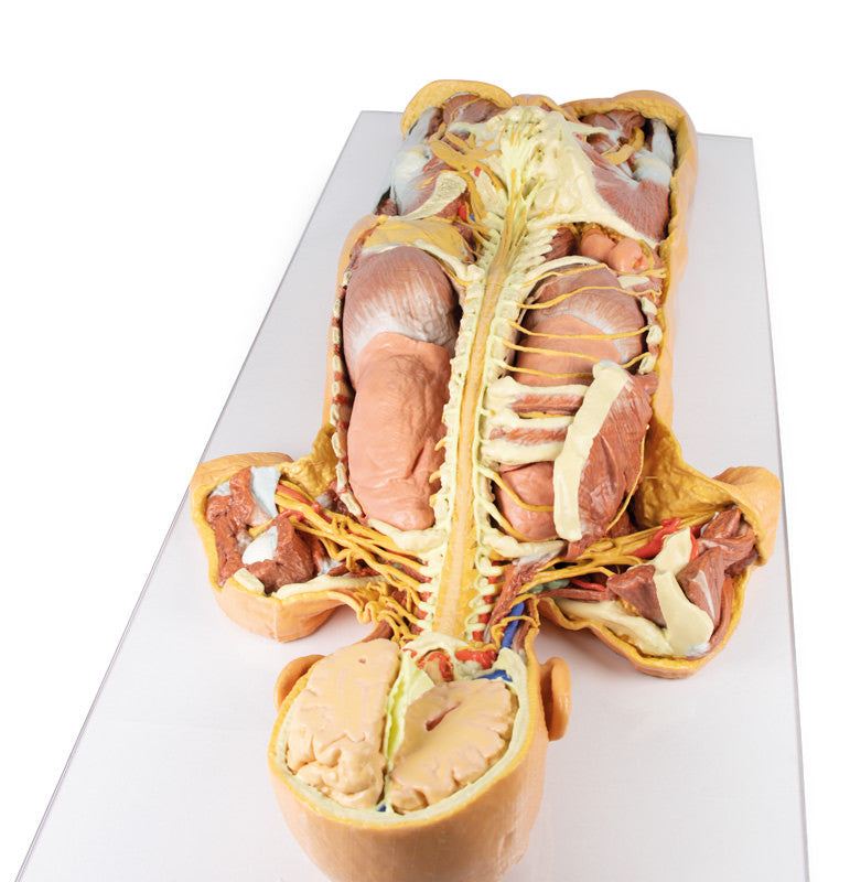 Nervous System Dissection (posterior view) - 3D Printed Cadaver