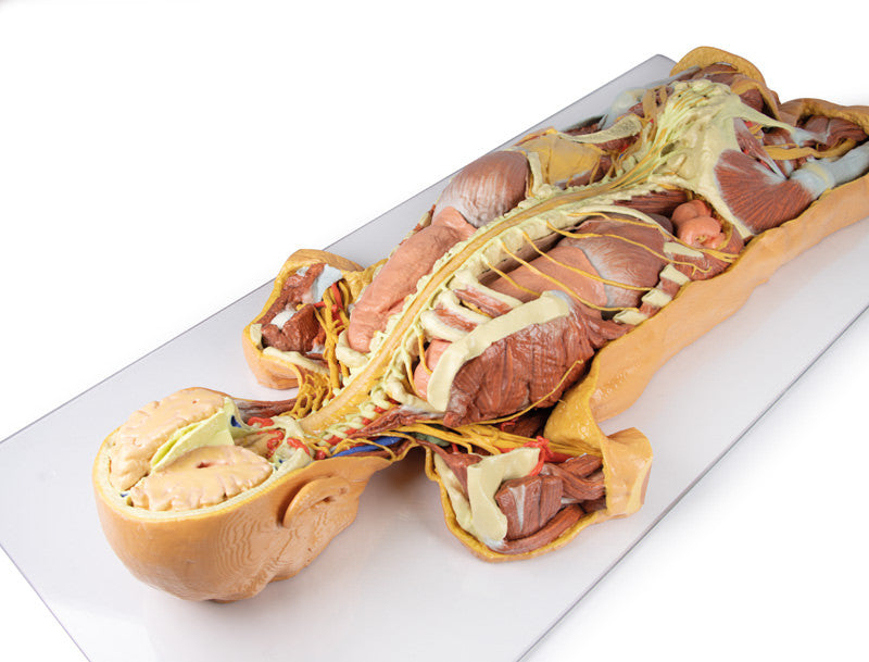 Nervous System Dissection (posterior view) - 3D Printed Cadaver