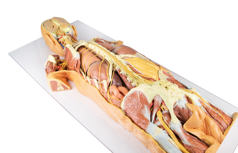 Nervous System Dissection (posterior view) - 3D Printed Cadaver