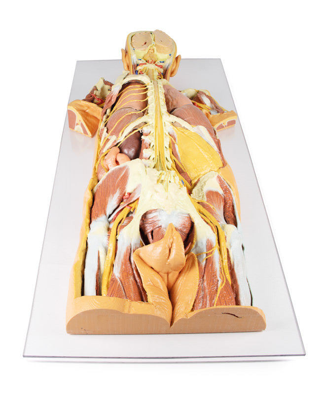 Nervous System Dissection (posterior view) - 3D Printed Cadaver