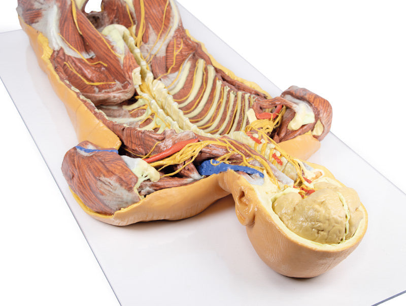 Posterior Body Wall / Ventral Deep Dissection - 3D Printed Cadaver