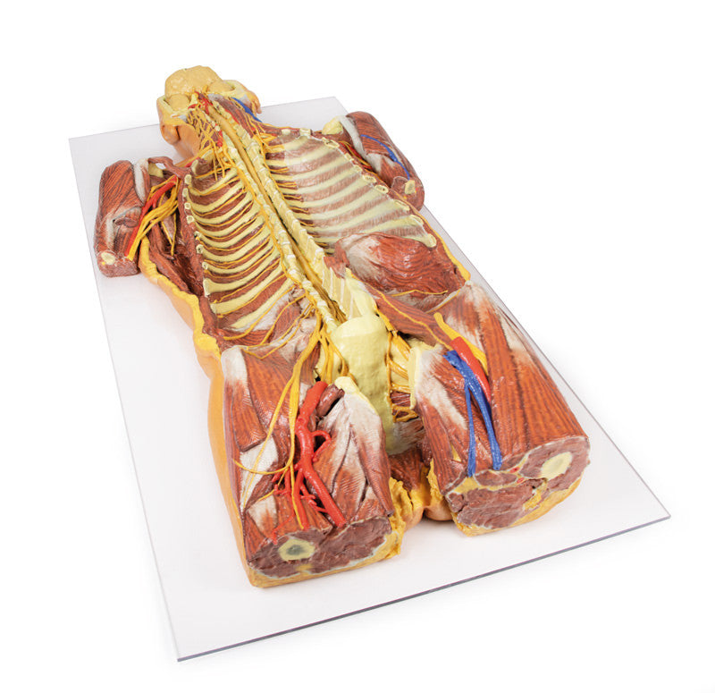 Posterior Body Wall / Ventral Deep Dissection - 3D Printed Cadaver