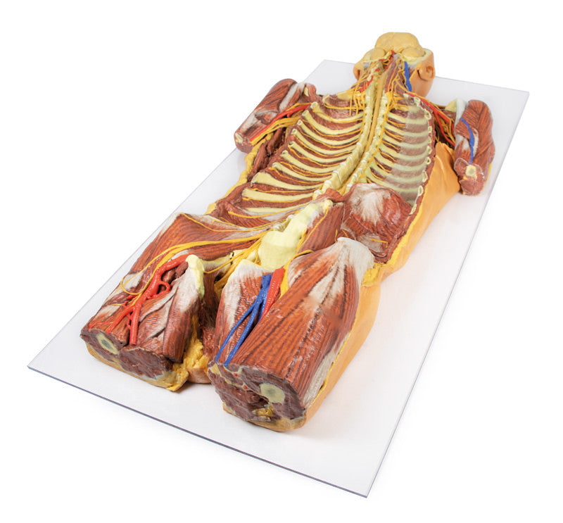 Posterior Body Wall / Ventral Deep Dissection - 3D Printed Cadaver