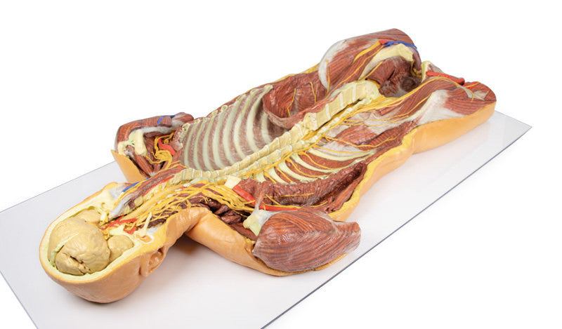Posterior Body Wall / Ventral Deep Dissection - 3D Printed Cadaver