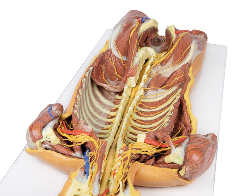 Posterior Body Wall / Ventral Deep Dissection - 3D Printed Cadaver