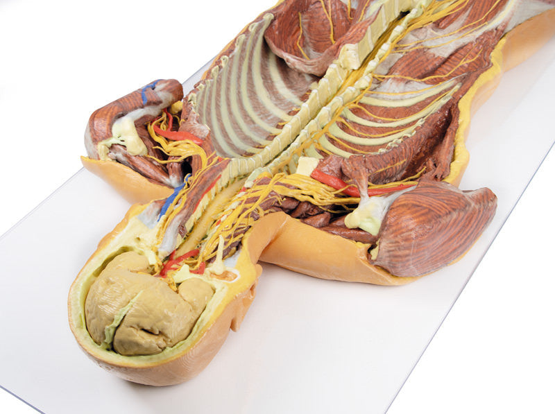 Posterior Body Wall / Ventral Deep Dissection - 3D Printed Cadaver