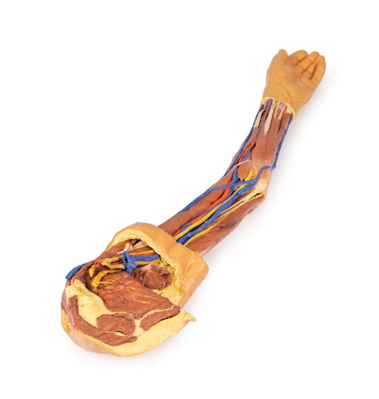 Upper Limb - 3D Printed Cadaver