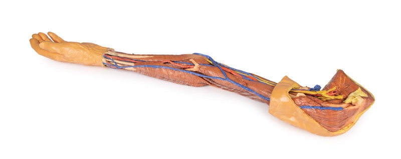 Upper Limb - 3D Printed Cadaver