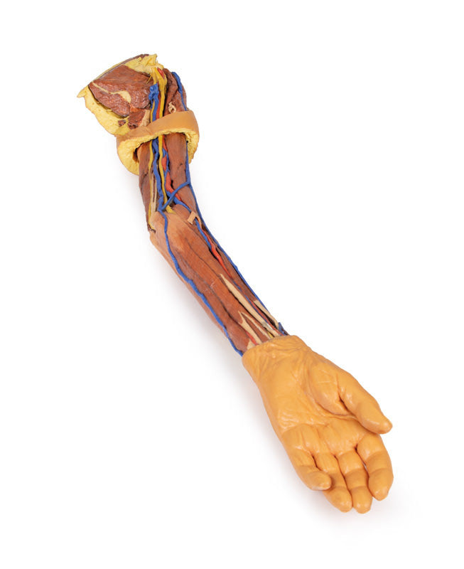 Upper Limb - 3D Printed Cadaver