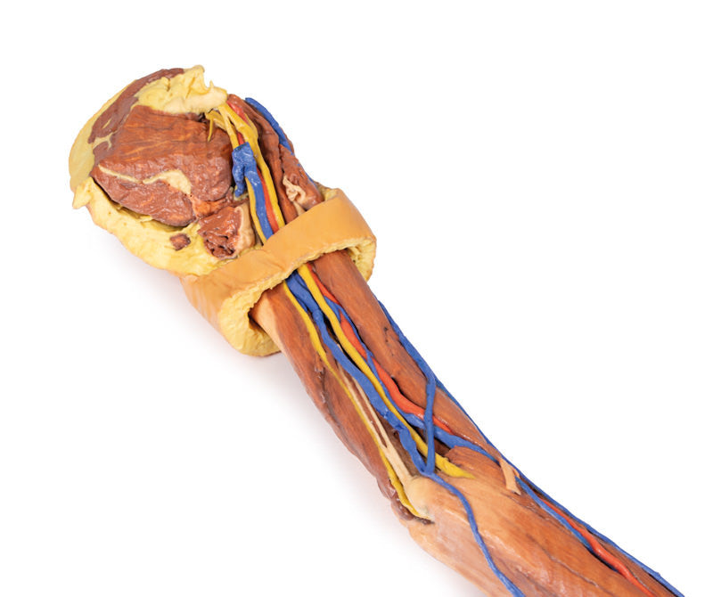 Upper Limb - 3D Printed Cadaver