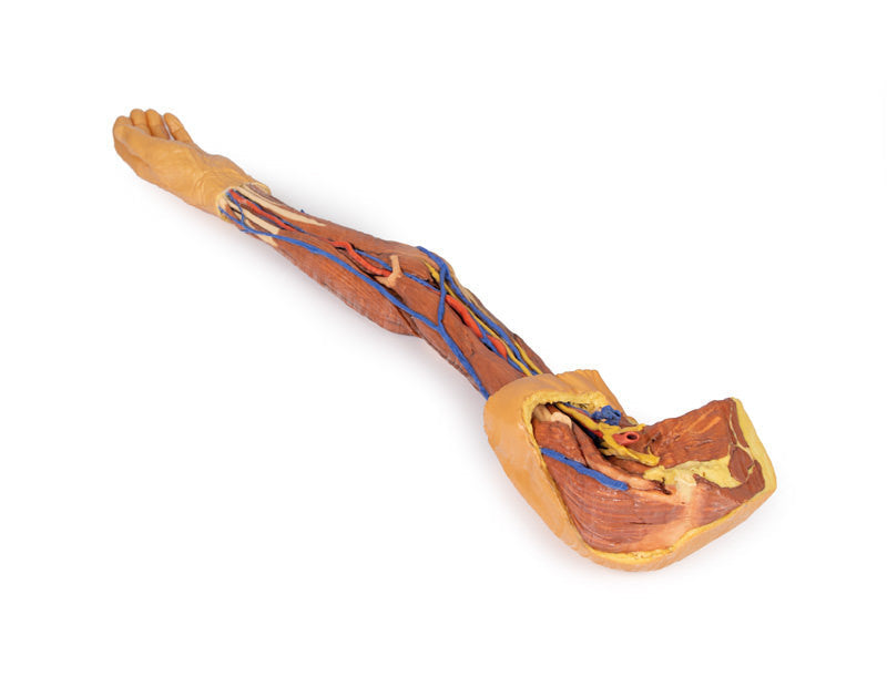 Upper Limb - 3D Printed Cadaver