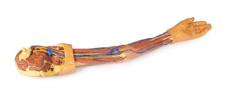 Upper Limb - 3D Printed Cadaver