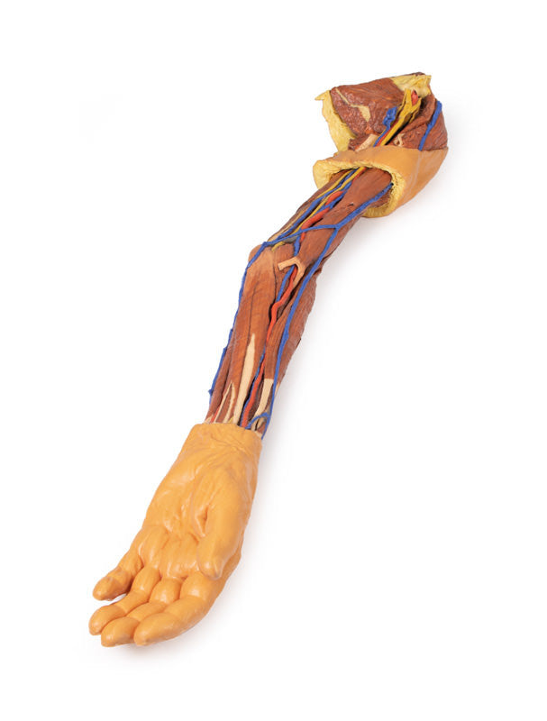 Upper Limb - 3D Printed Cadaver