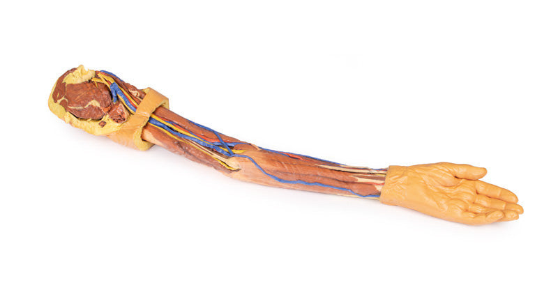 Upper Limb - 3D Printed Cadaver