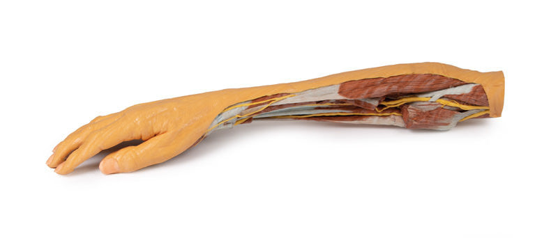 Forearm and Hand - superficial and deep dissection - 3D Printed Cadaver