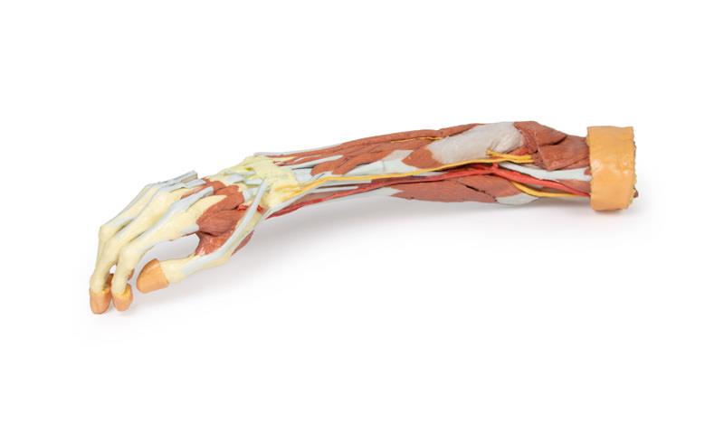 Deep upper limb and hand