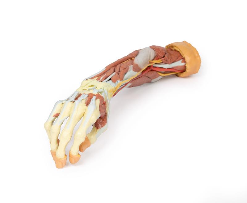 Deep upper limb and hand