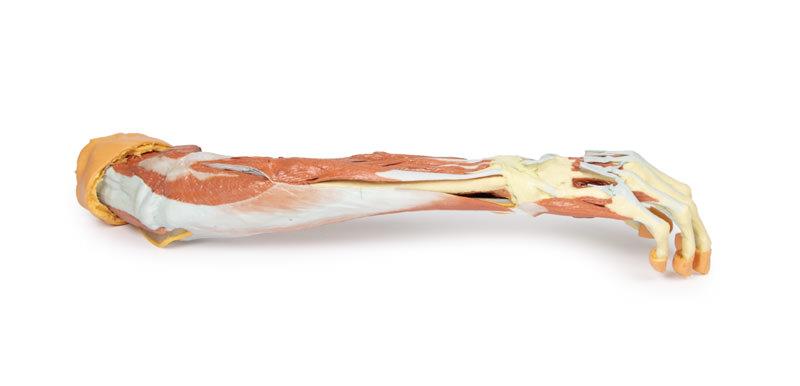 Deep upper limb and hand