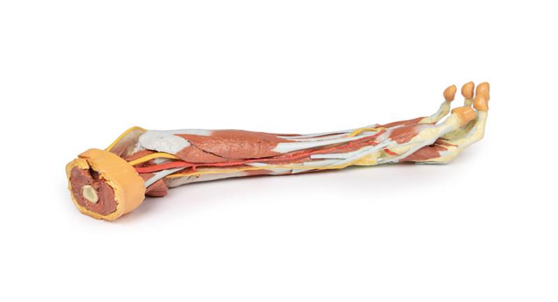 Deep upper limb and hand