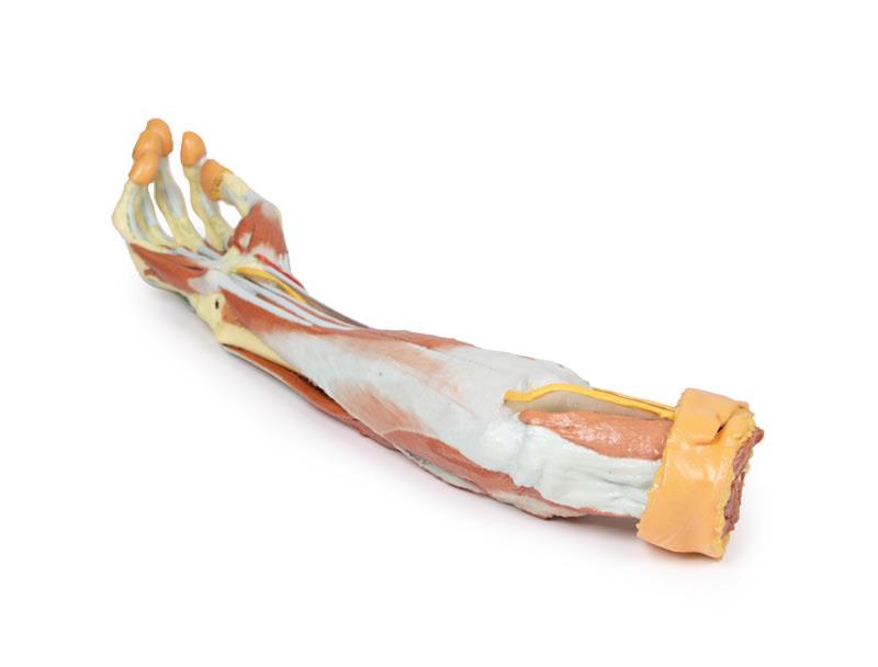 Deep upper limb and hand