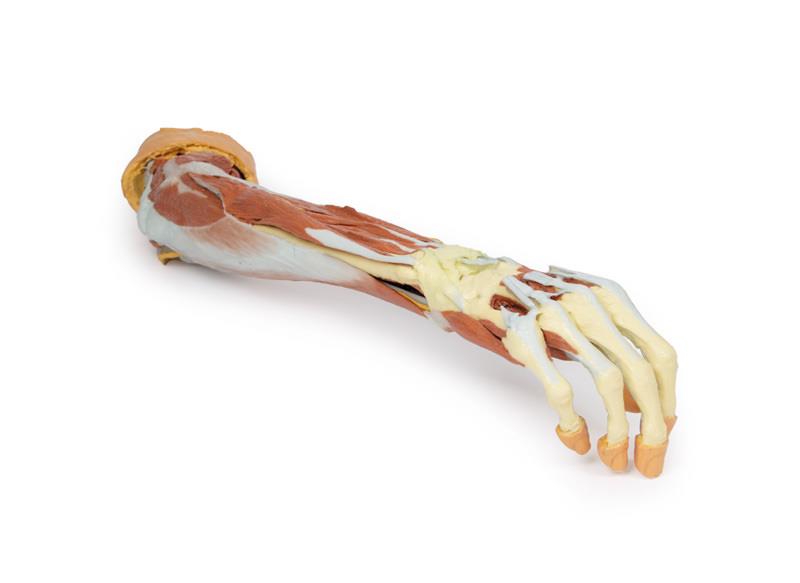 Deep upper limb and hand