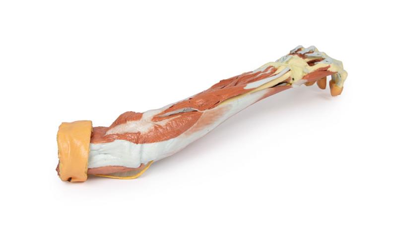 Deep upper limb and hand
